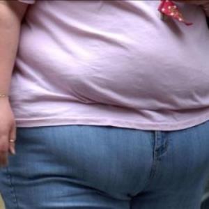 Should obese people be provided with the same access to treatment as others?